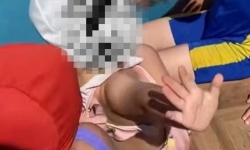 İnegöl'de kreş havuzuna düşen çocuk yaşam mücadelesi veriyor