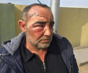 Şanlıurfalı sürücü Irak’ta yaralandı