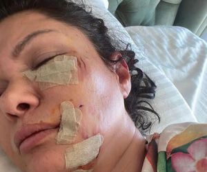 Ünlü şarkıcı Tuğba Altıntop köpek saldırısına uğradı