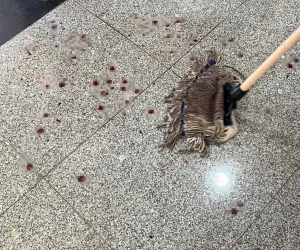 Bıçaklı saldırıya uğrayan dekan yardımcısı: “Şahsı kontrol altına alana kadar defalarca bıçağı bana saplamaya çalıştı”