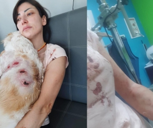 Köpeklerin saldırısından canını zor kurtardı