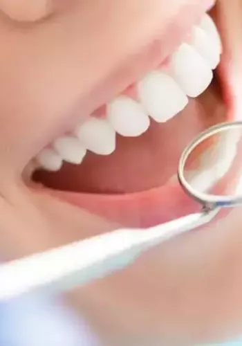 Diş Sağlığına İyi Gelen 5 Harika Besin