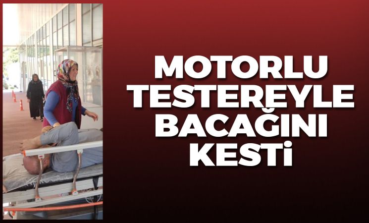 Motorlu testere ile odun keserken bacağını kesti