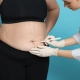 Liposuction Nedir? Bölgesel Yağlanmaya Kalıcı Çözüm mü?